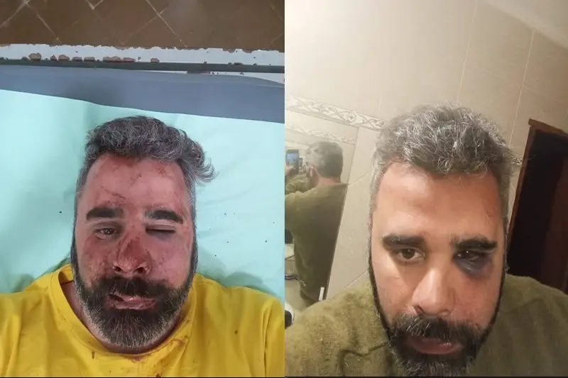 Le propinaron una brutal golpiza el presidente del Partido Libertario