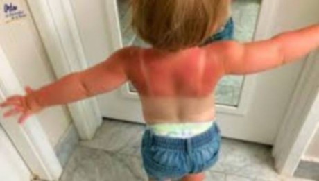 EL SOL Y LOS NIOS.Recomendaciones de ALCEC